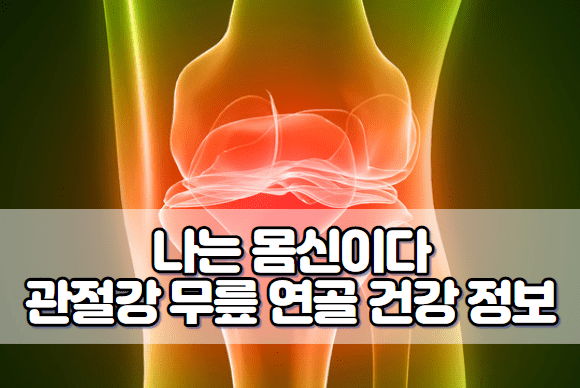 나는 몸신이다 관절강