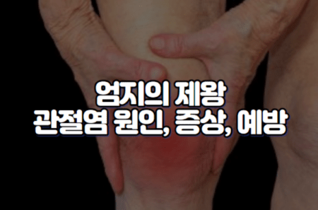 엄지의 제왕 관절염 원인