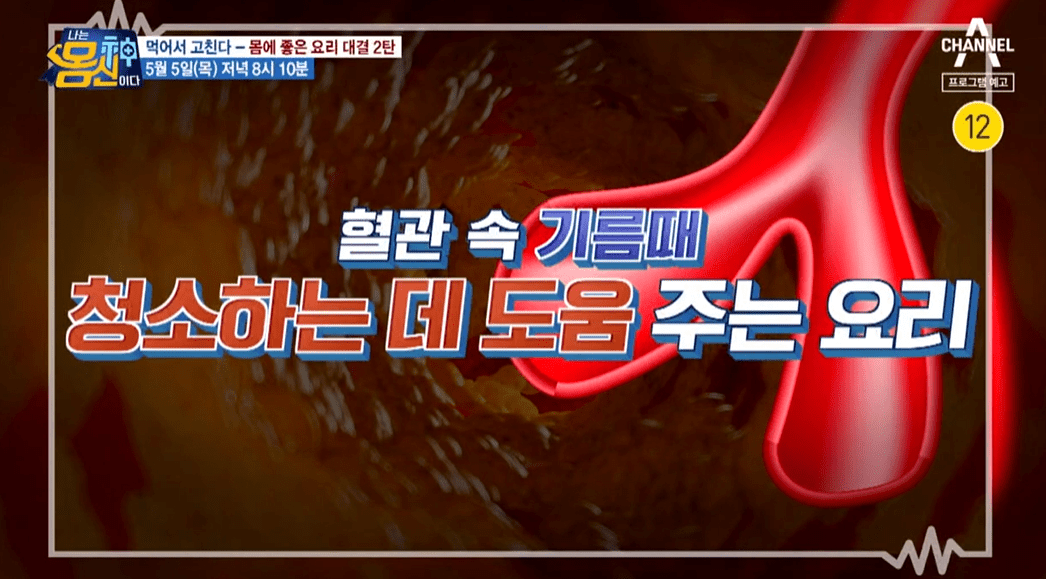 나는 몸신이다 혈관