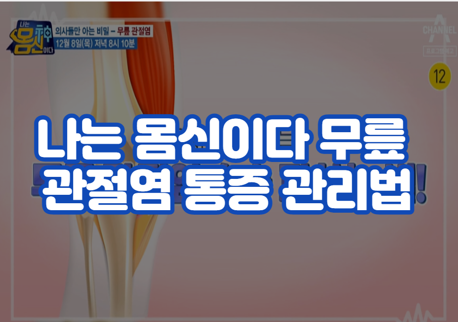 나는 몸신이다 무릎 관절염